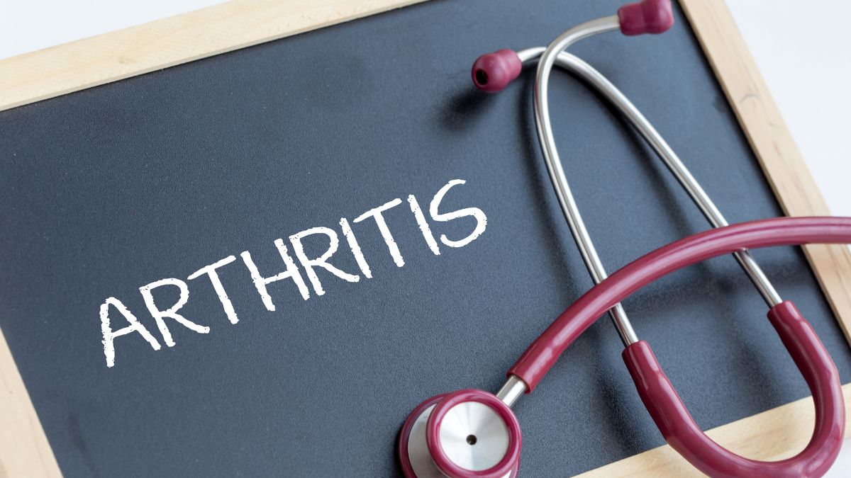 Arthrite