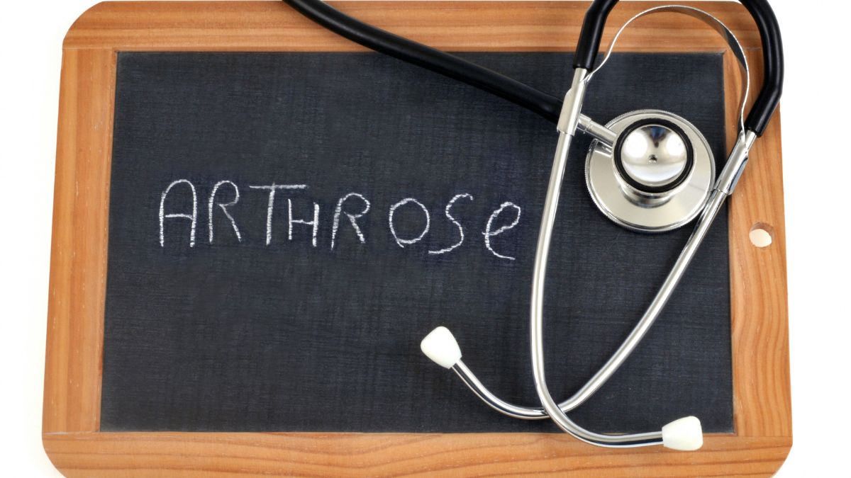 Arthrose