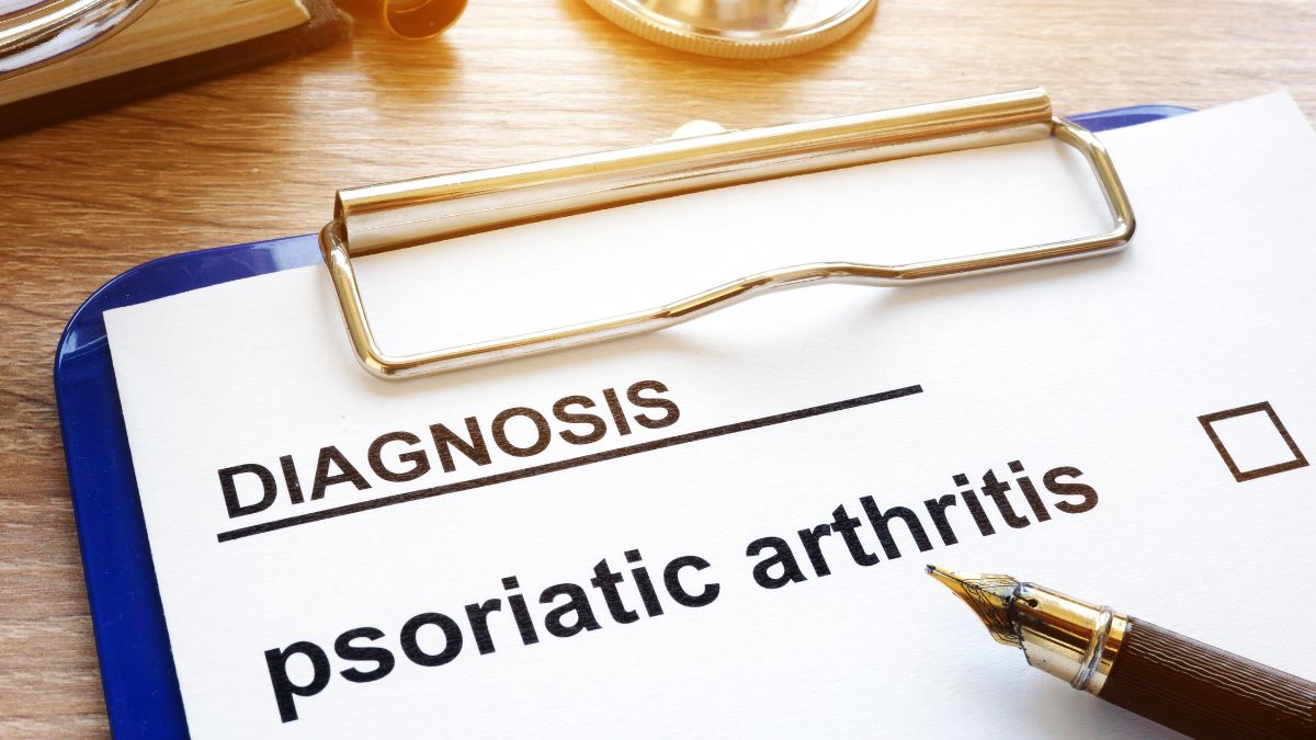 Étude STAMP : faut-il introduire une biothérapie d’emblée dans le rhumatisme psoriasique ?