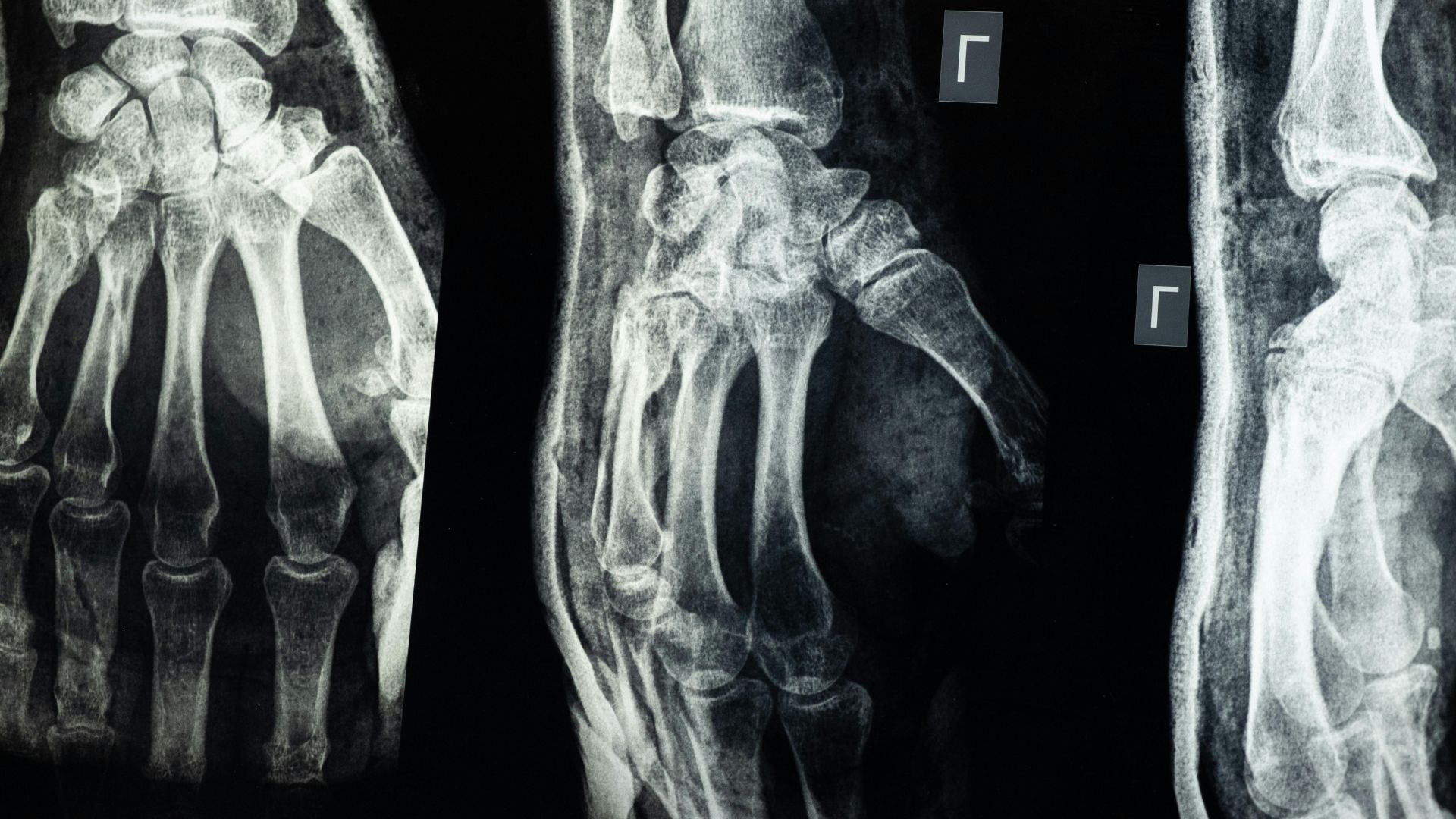 Partagez vos plus belles images cliniques ou radiologiques !