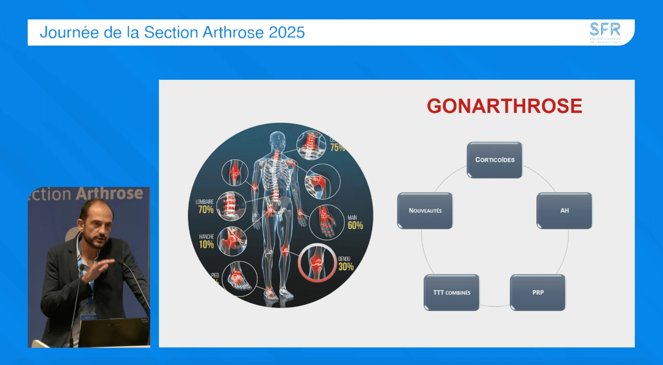 Capture d’écran 2025-09-25 à 16.00.38 Traitements intra-articulaires de l’arthrose