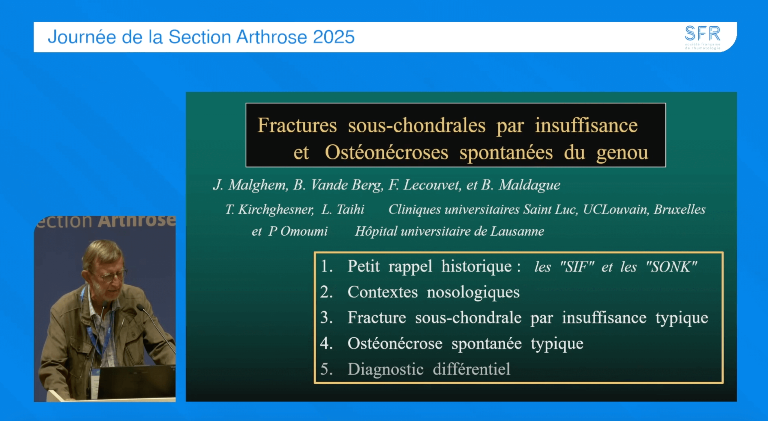 Fissure sous-chondrale par insuffisance osseuse Fissure sous-chondrale par insuffisance osseuse