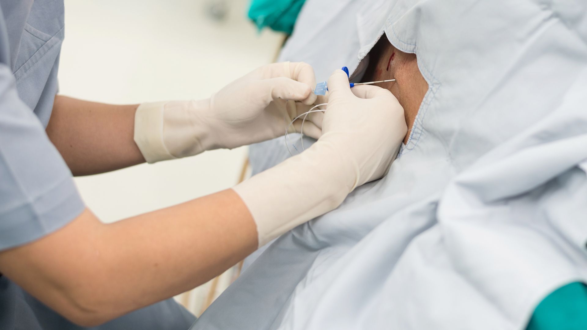 Etude négative sur l&rsquo;efficacité des injections épidurales de dexaméthasone par la voie du hiatus sacro-coccygien dans les lombosciatique discales récentes