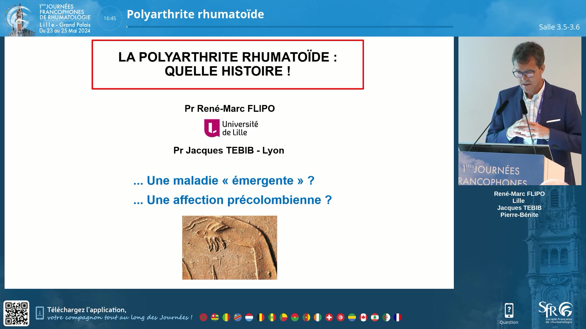 Polyarthrite rhumatoïde