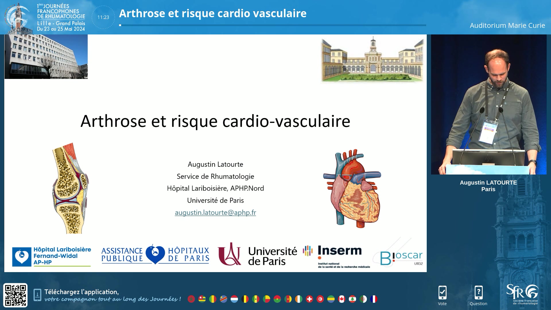 Arthrose et risque cardio vasculaire