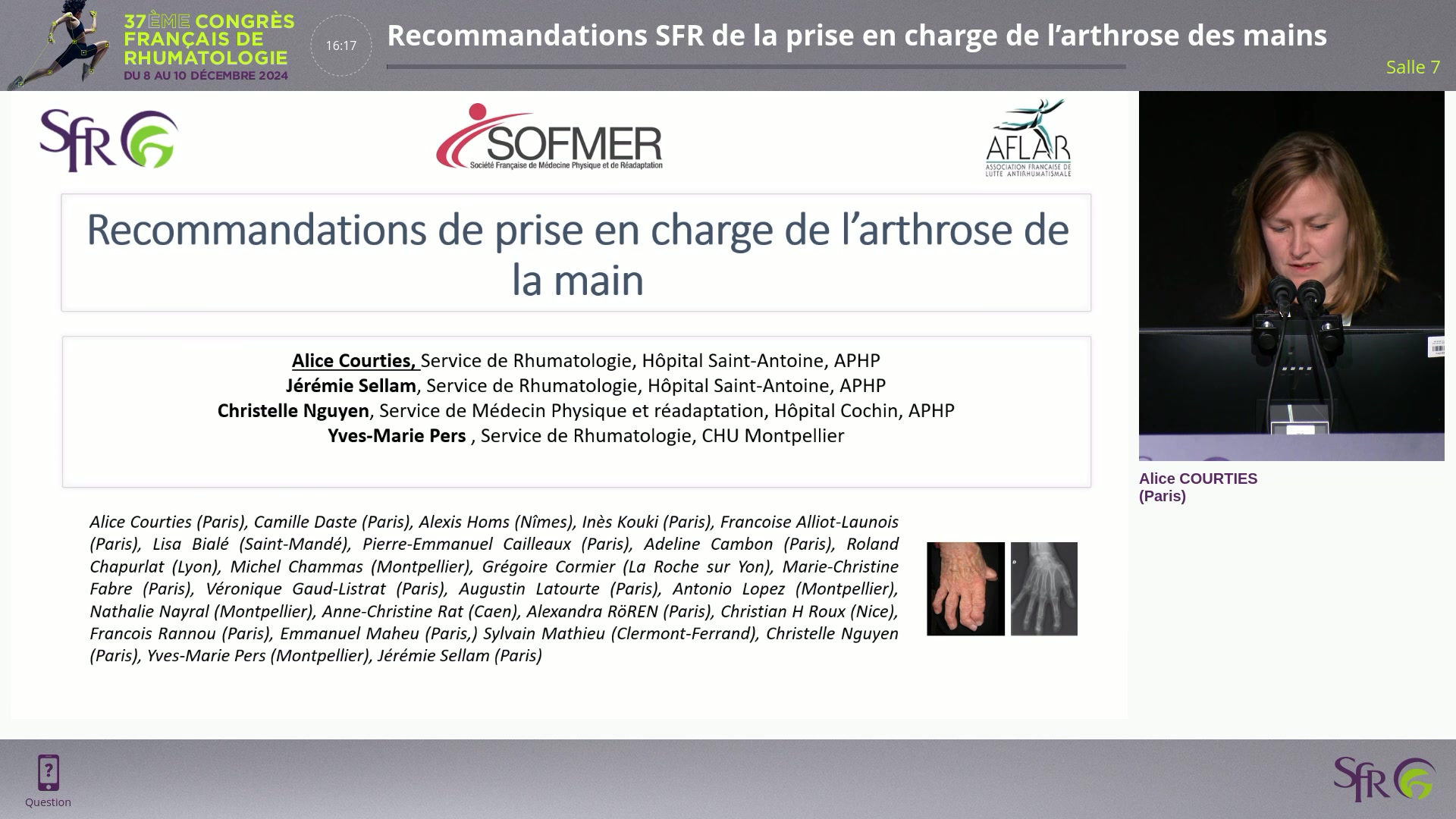 Recommandations SFR de la prise en charge de l’arthrose des mains
