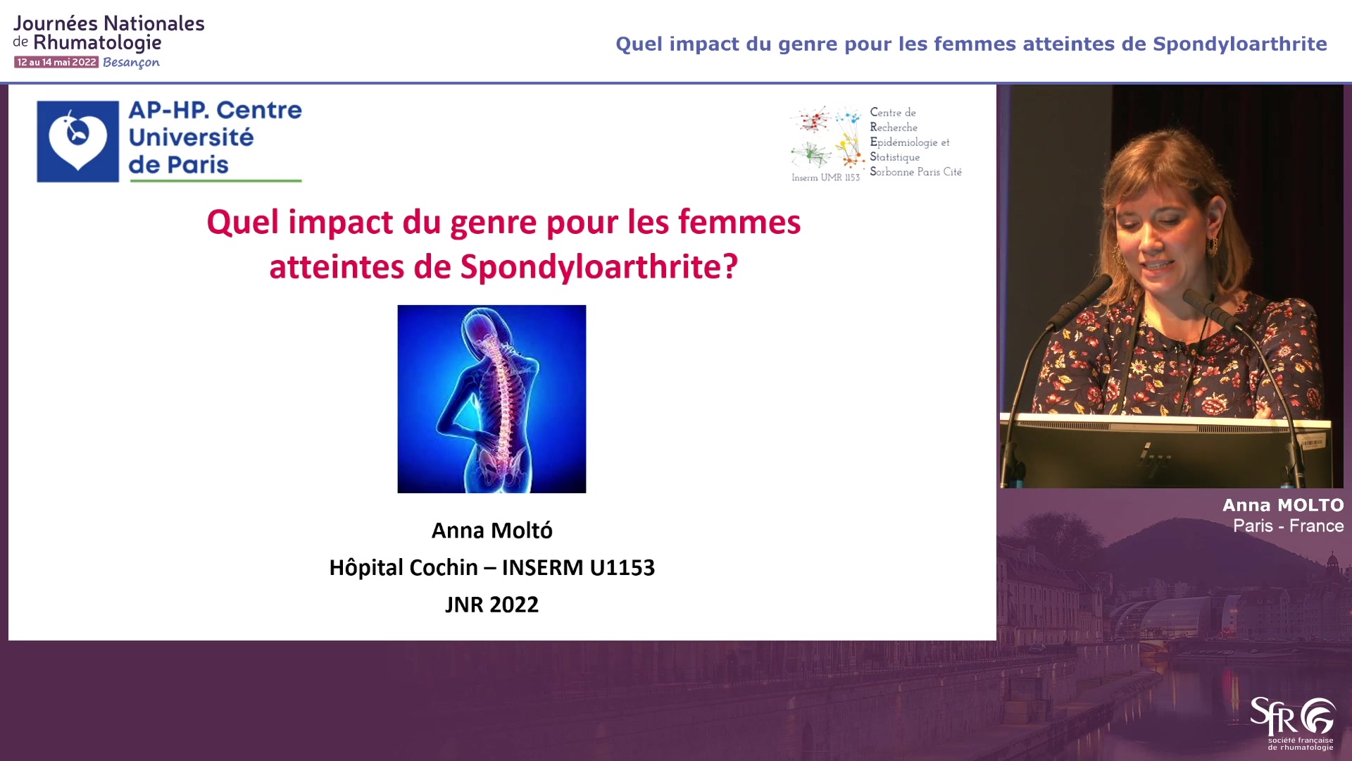 Quel impact du genre pour les femmes atteintes de Spondyloarthrite