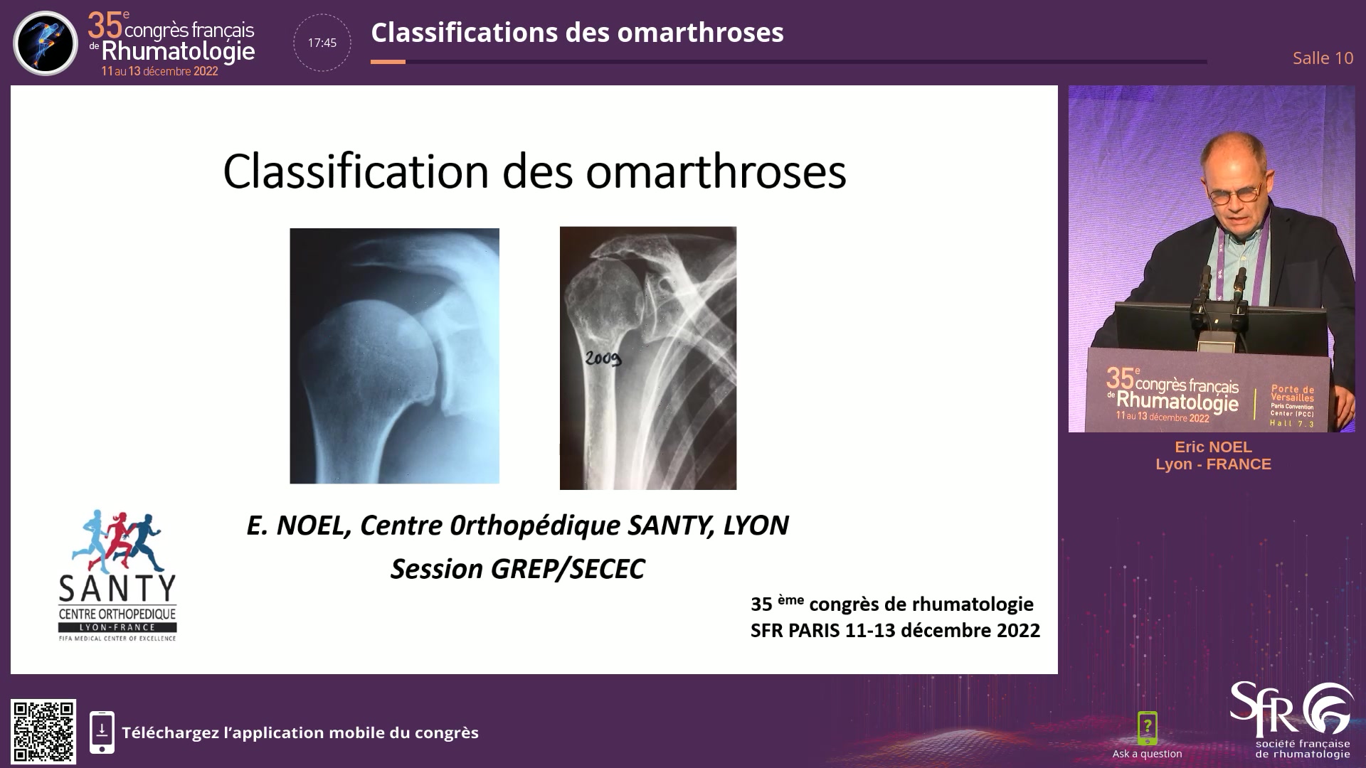 Classifications des omarthroses