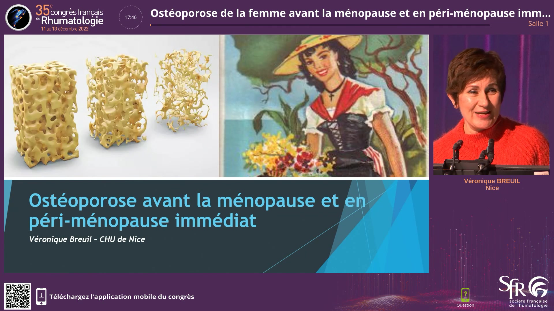 Ostéoporose de la femme avant la ménopause et en péri-ménopause immédiat