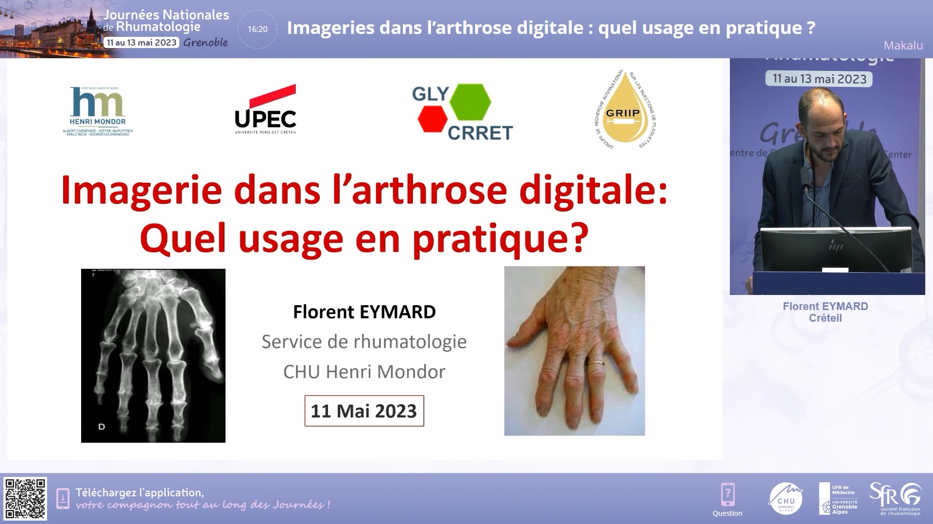 Imageries dans l’arthrose digitale : quel usage en pratique ?