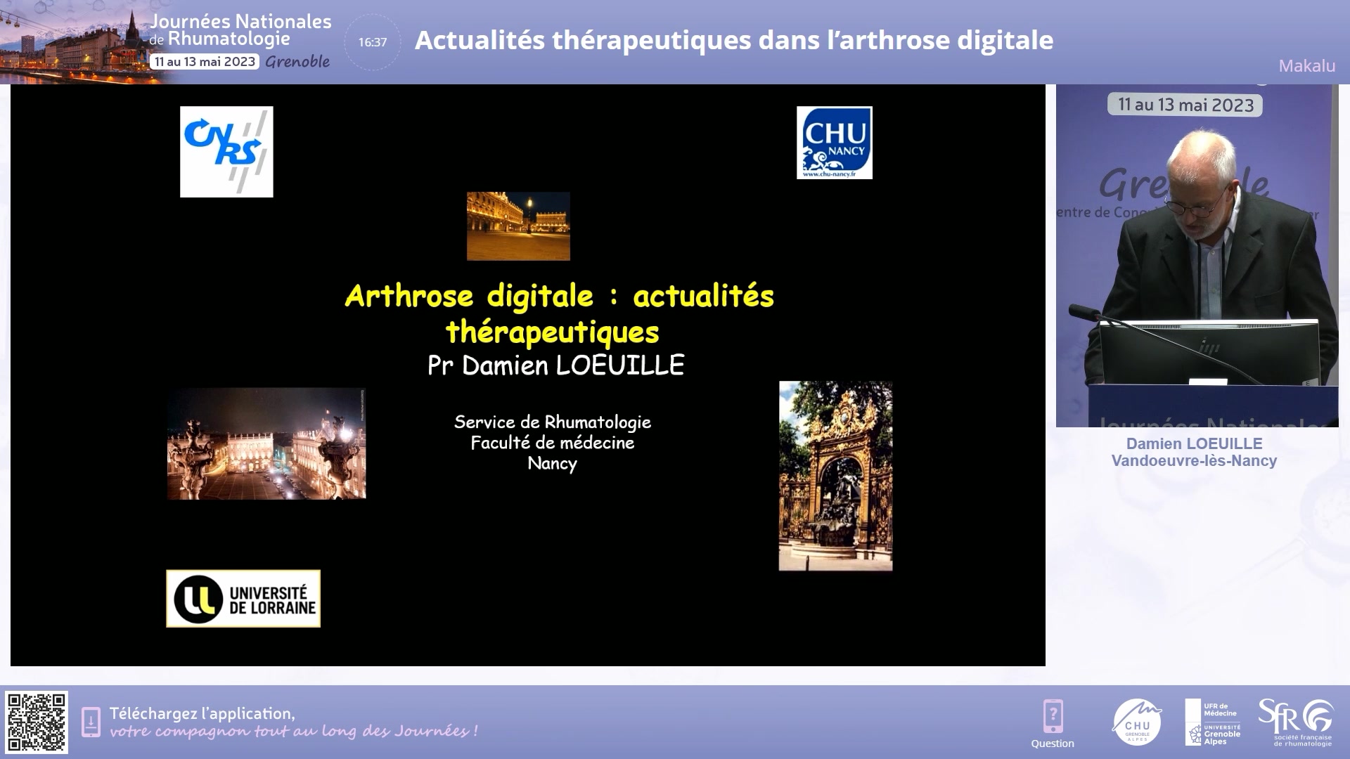 Actualités thérapeutiques dans l’arthrose digitale