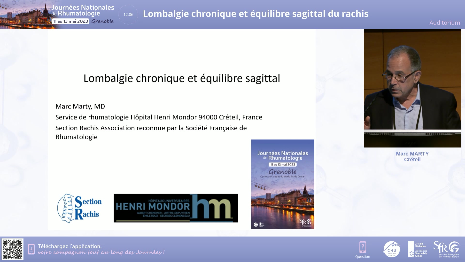 Lombalgie chronique et équilibre sagittal du rachis