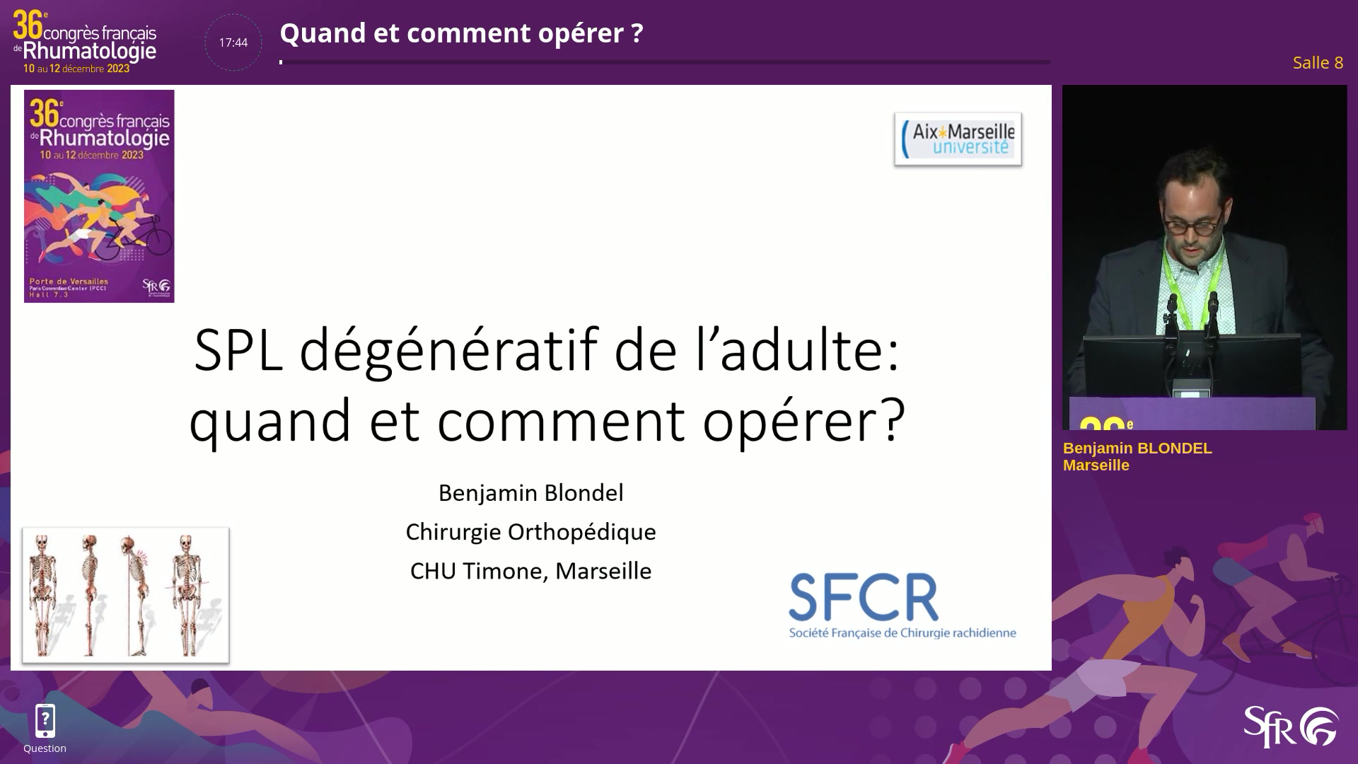 Quand et comment opérer ?