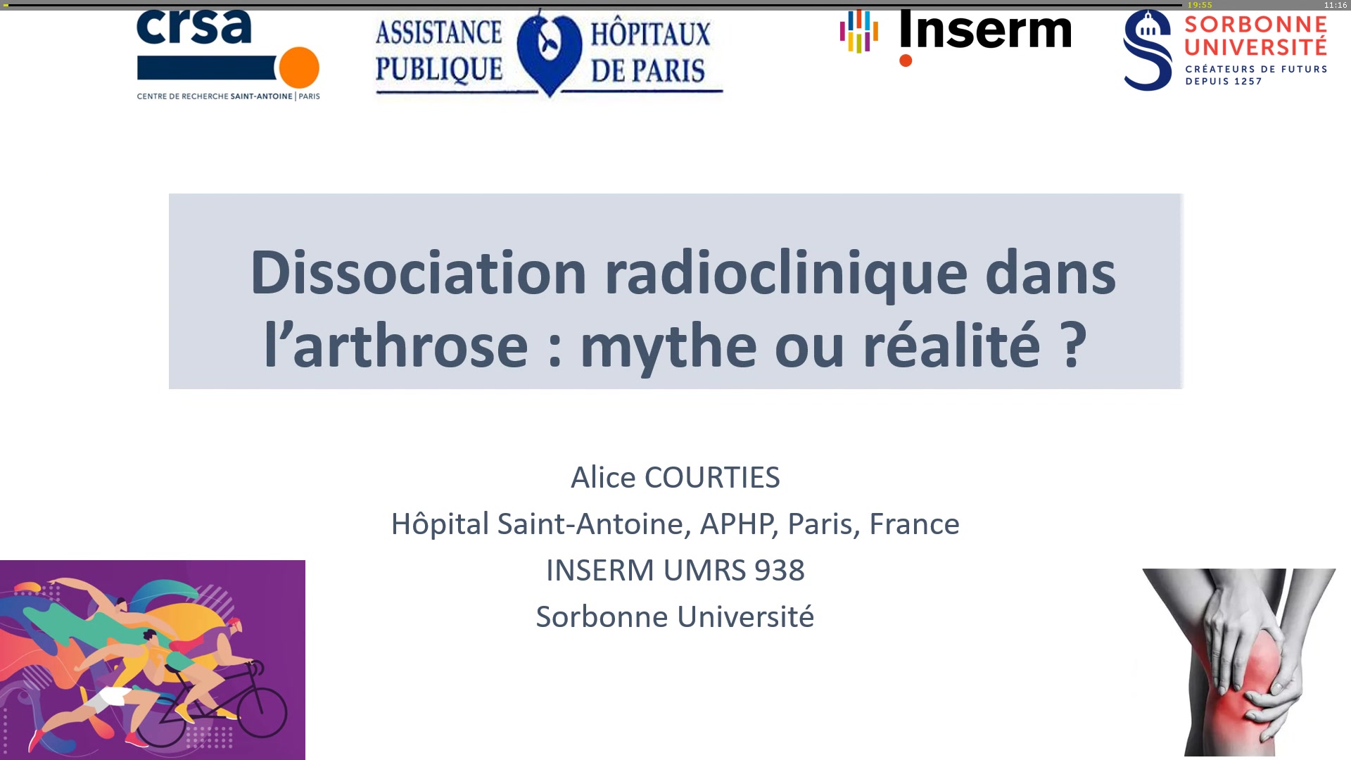 Dissociation radioclinique dans l’arthrose : mythe ou réalité ?