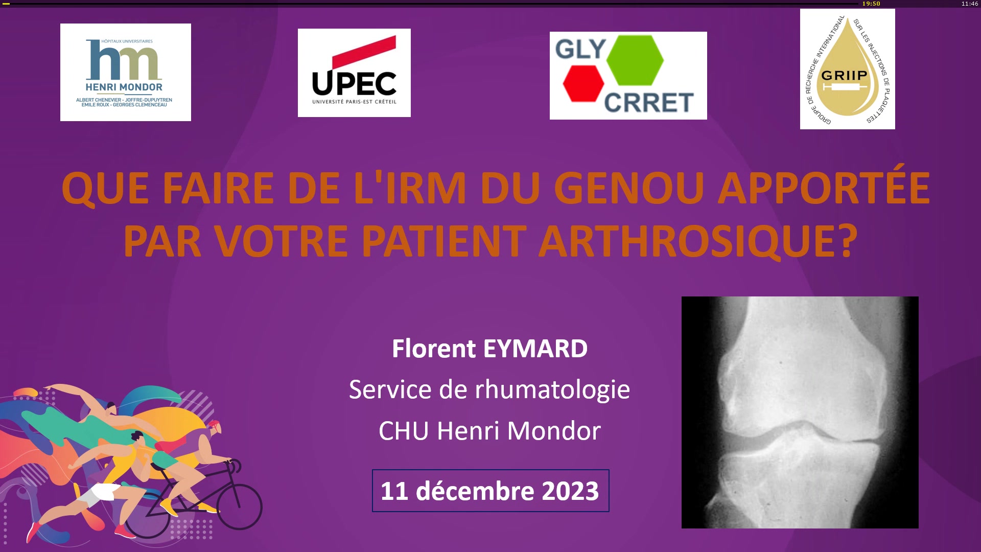Que faire de l’IRM du genou apportée par votre patient arthrosique ?