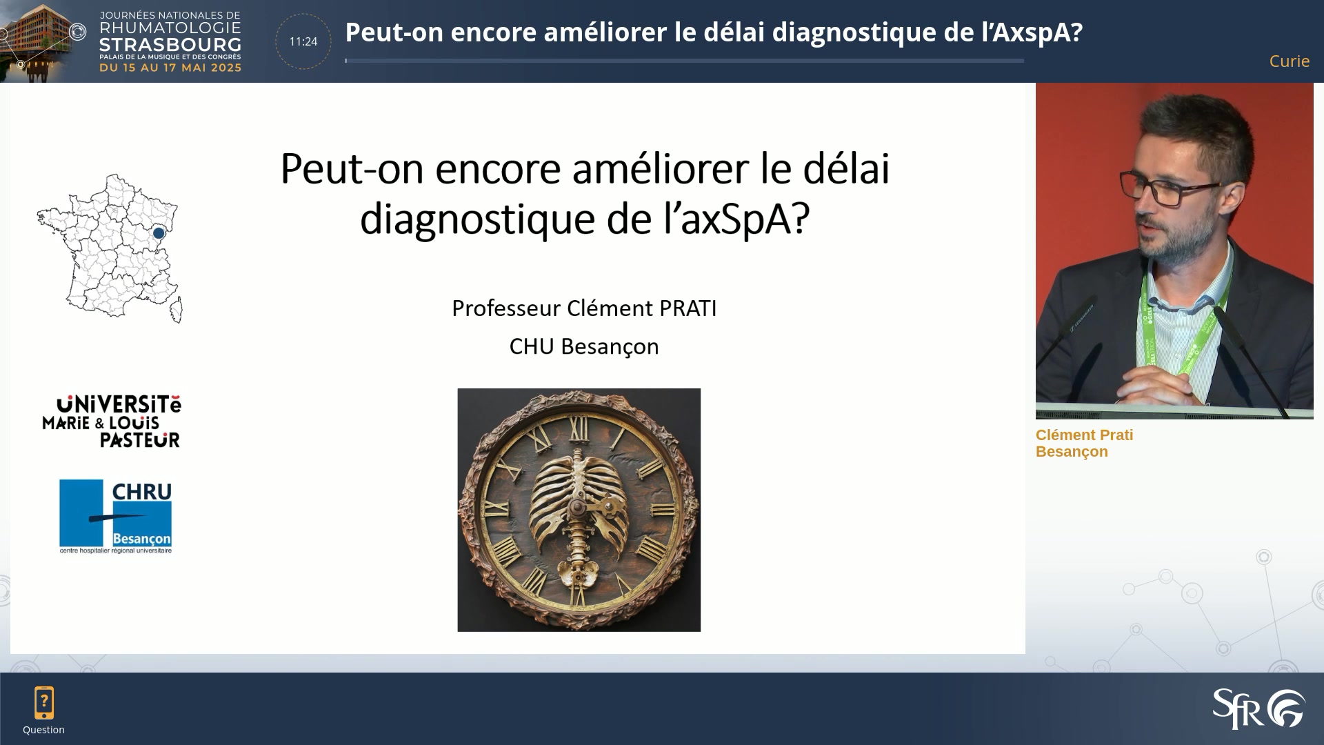Peut-on encore améliorer le délai diagnostique de l’AxspA?