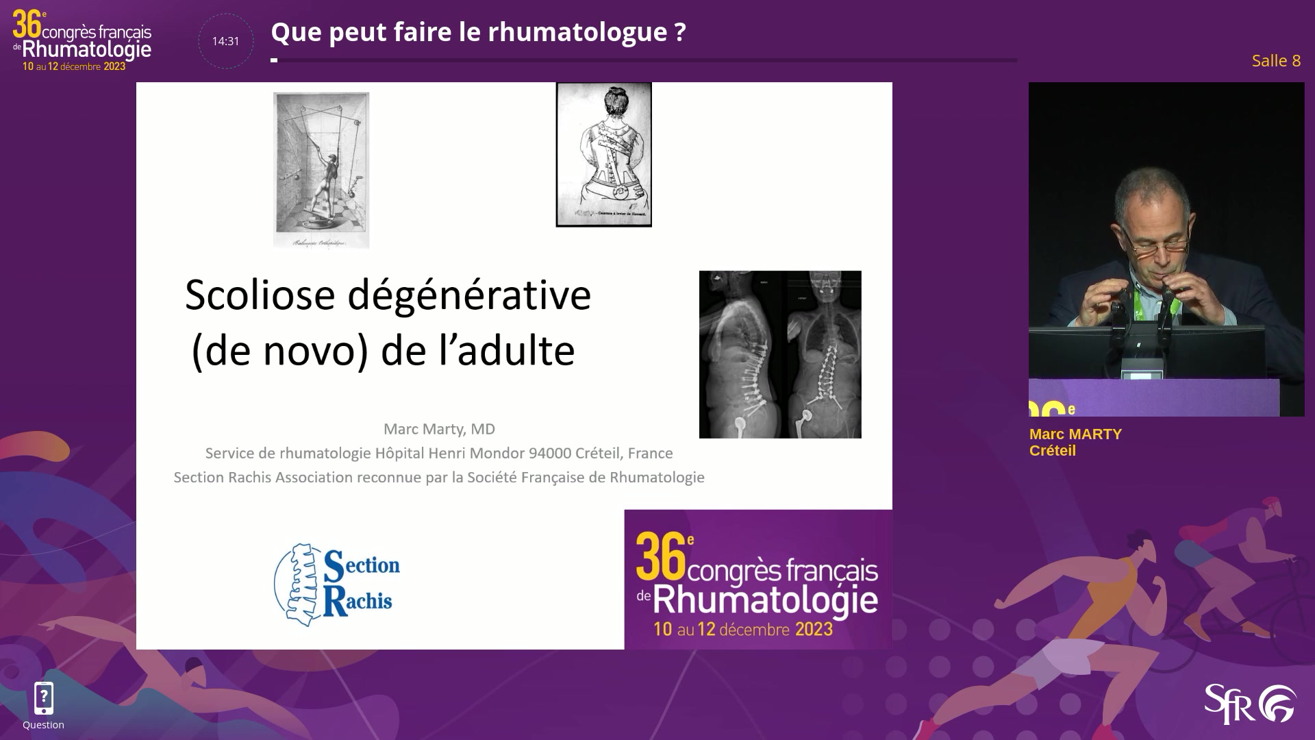 Que peut faire le rhumatologue ?