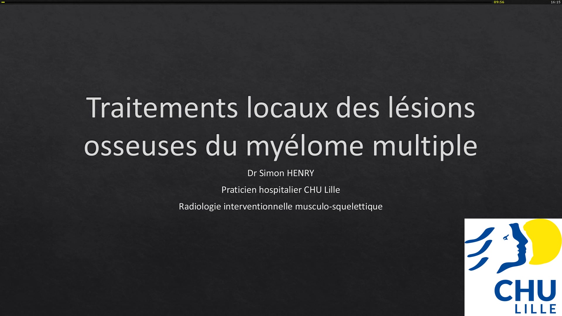 Traitements locaux des lésions osseuses du myélome multiple