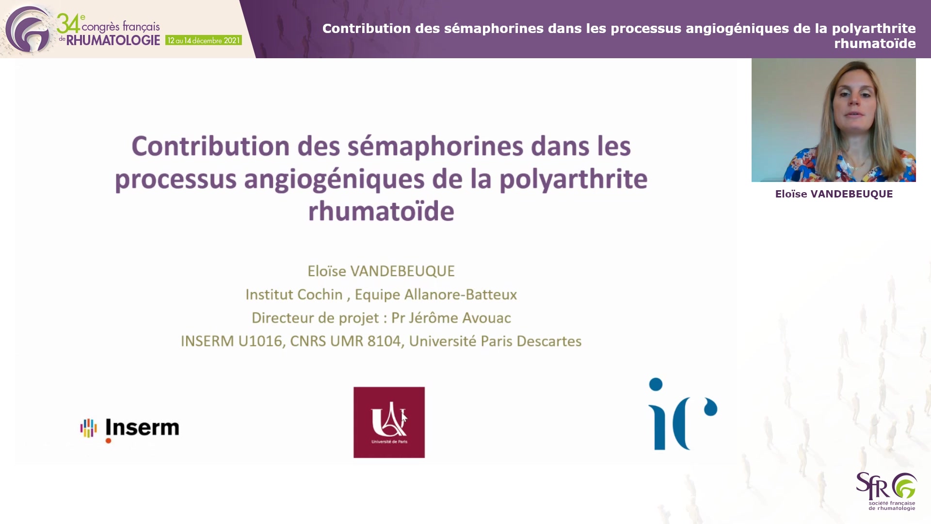 Contribution des sémaphorines dans les processus angiogéniques de la polyarthrite rhumatoïde