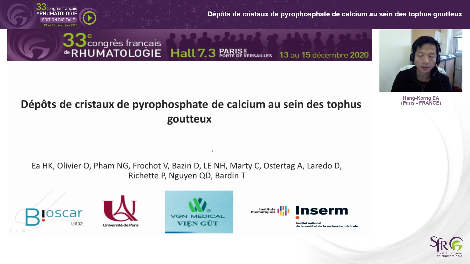 Dépôts de cristaux de pyrophosphate de calcium au sein des tophus goutteux