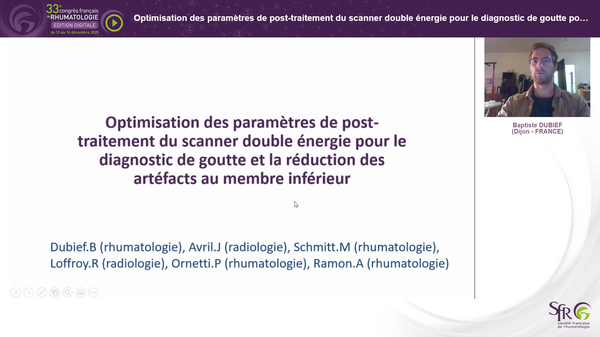 Optimisation des paramètres de post-traitement du scanner double énergie pour le diagnostic de goutte pour la réduction des artéfacts aux membres inférieurs
