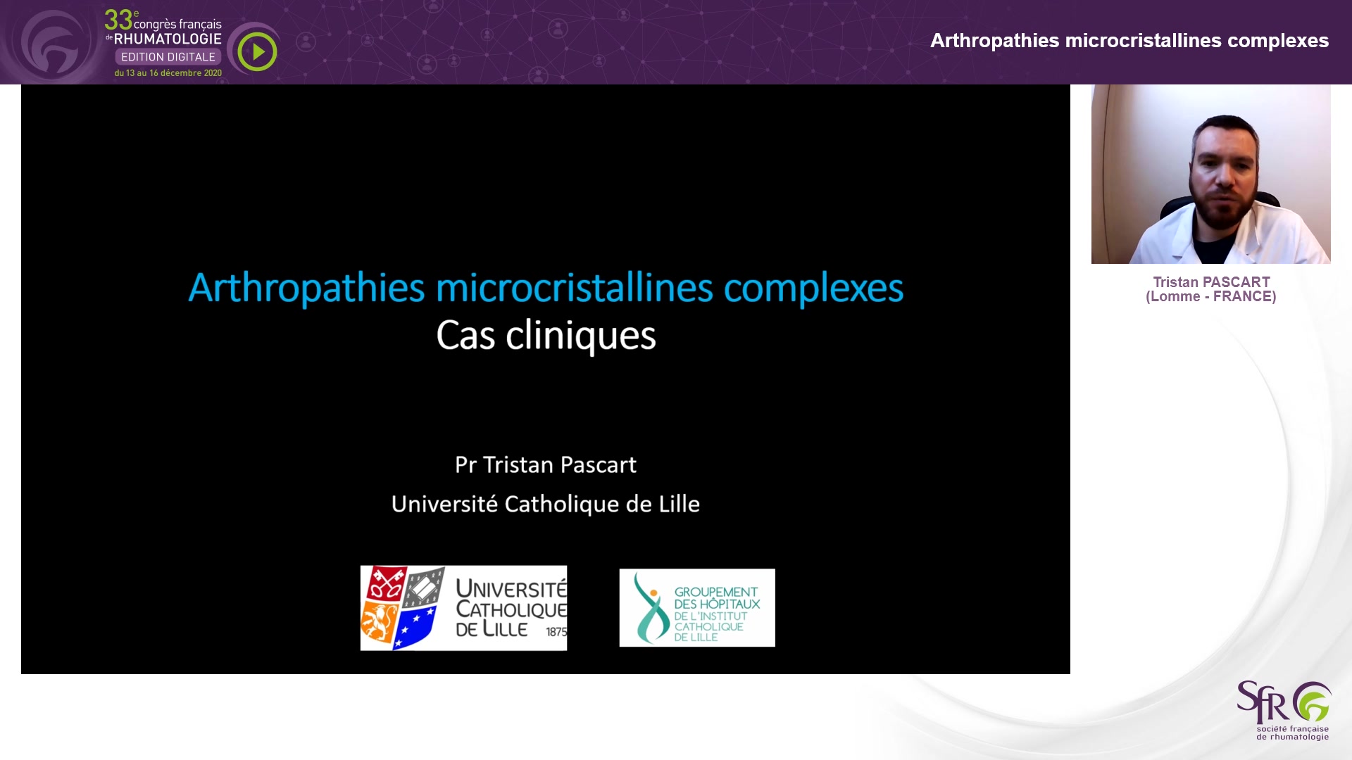 Arthropathies microcristallines complexes
