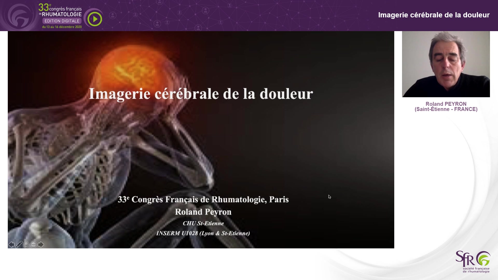 Imagerie cérébrale de la douleur