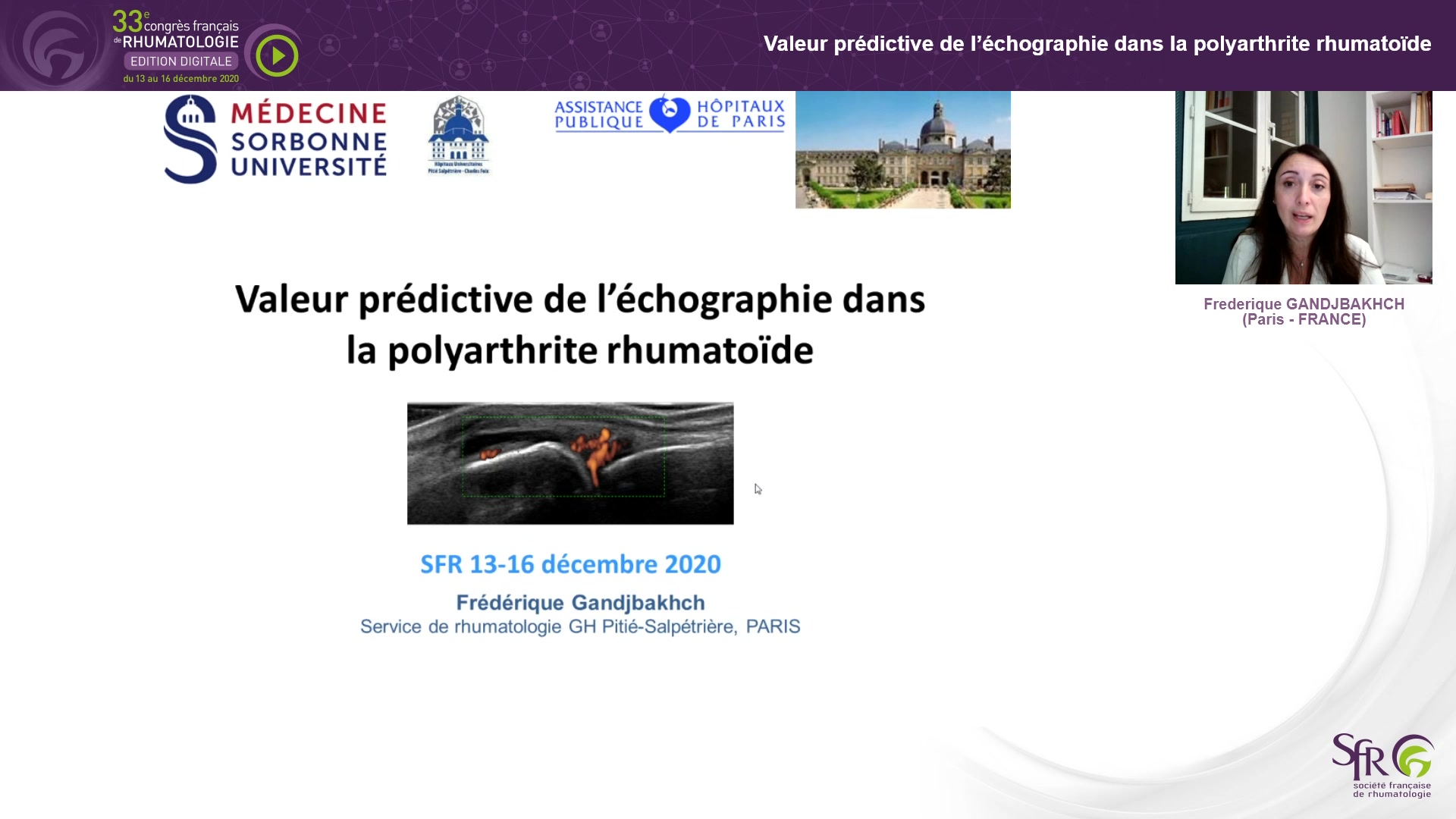 Valeur prédictive de l’échographie dans la polyarthrite rhumatoïde