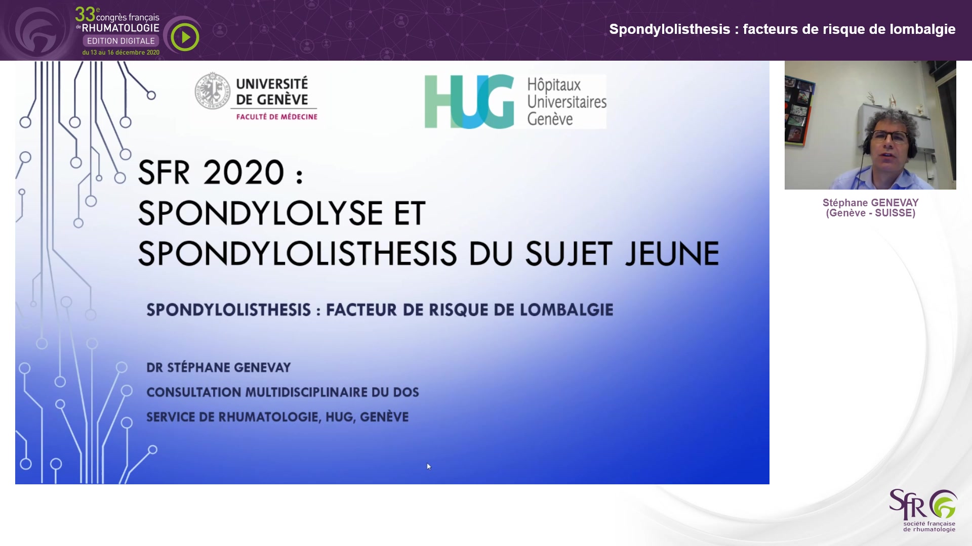 Spondylolisthesis : facteurs de risque de lombalgie