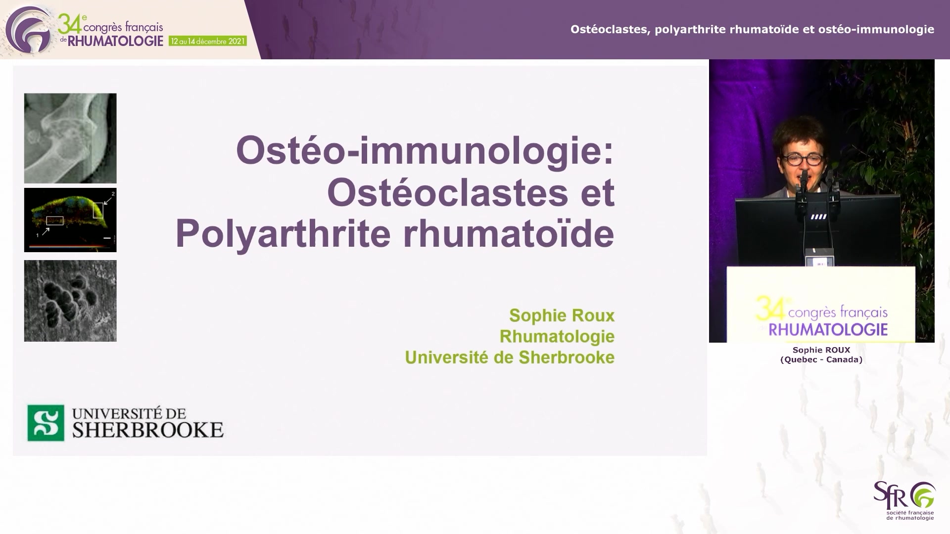 Ostéoclastes, polyarthrite rhumatoïde et ostéo-immunologie