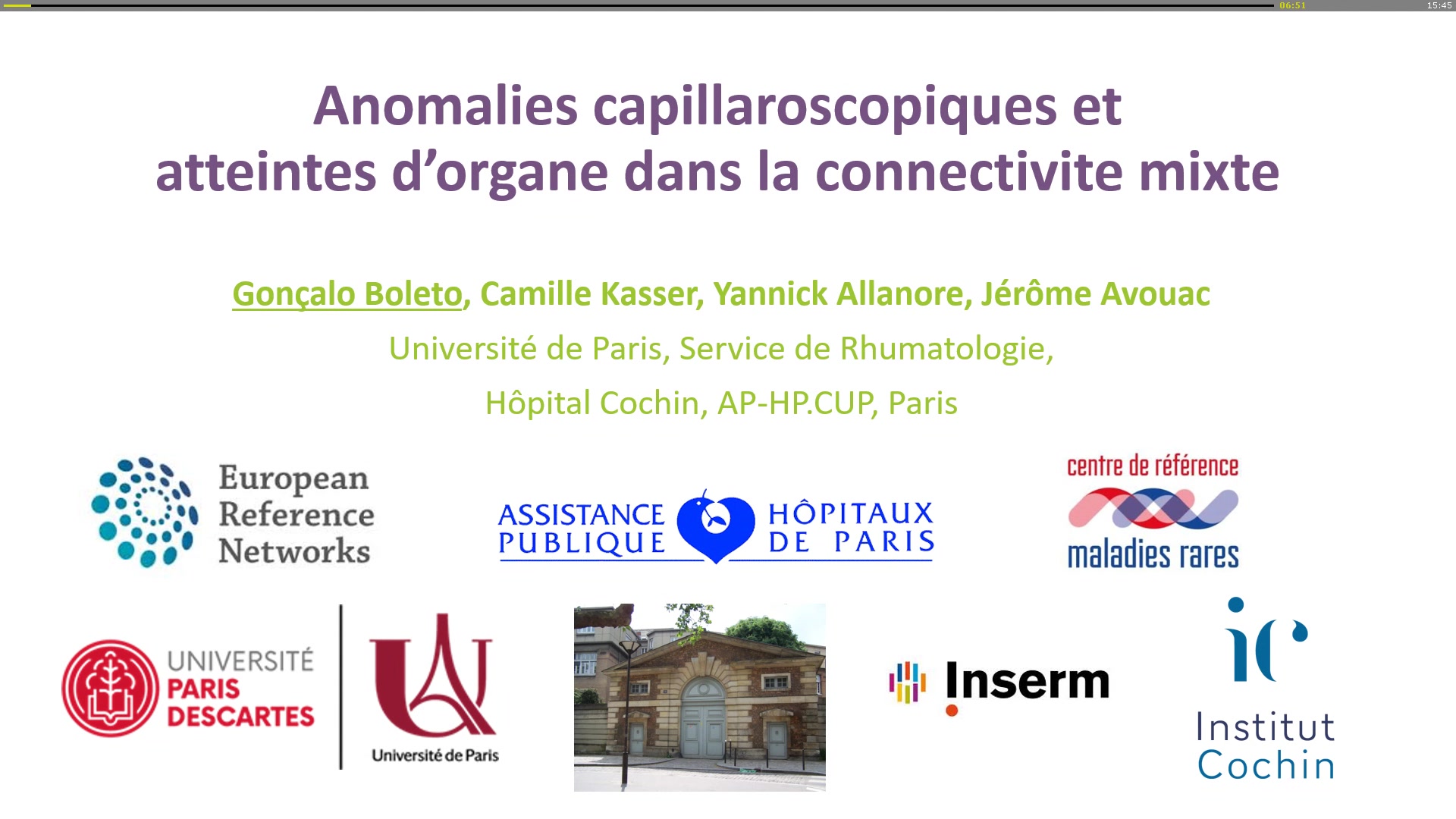 Anomalies capillaroscopiques et atteintes d’organe dans la connectivite mixte (syndrome de Sharp)