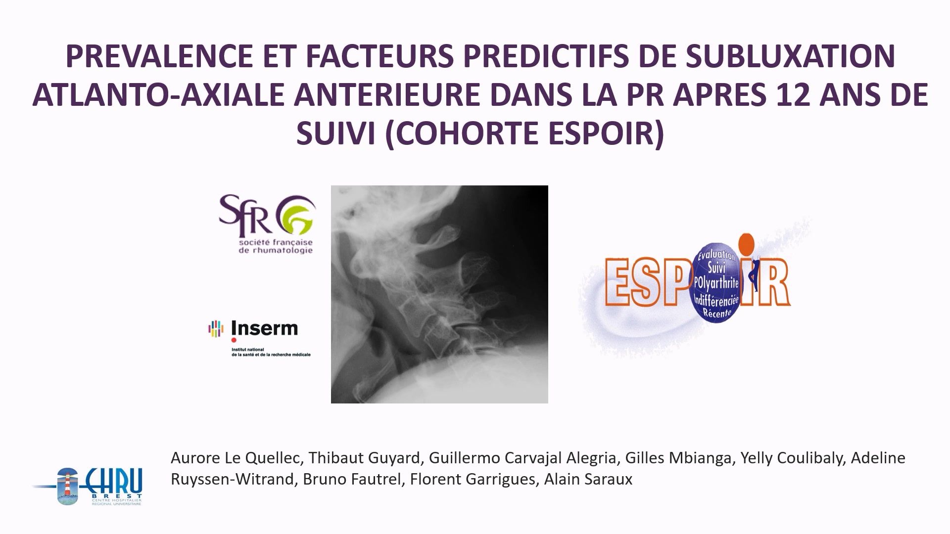 Prévalence de la luxation atloïdo-axoïdienne antérieure dans la polyarthrite rhumatoïde après 12 ans d’évolution