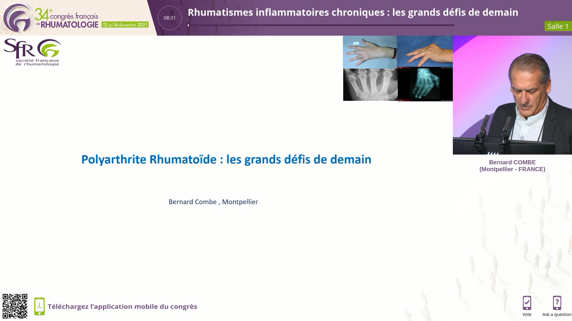 Rhumatismes inflammatoires chroniques : les grands défis de demain