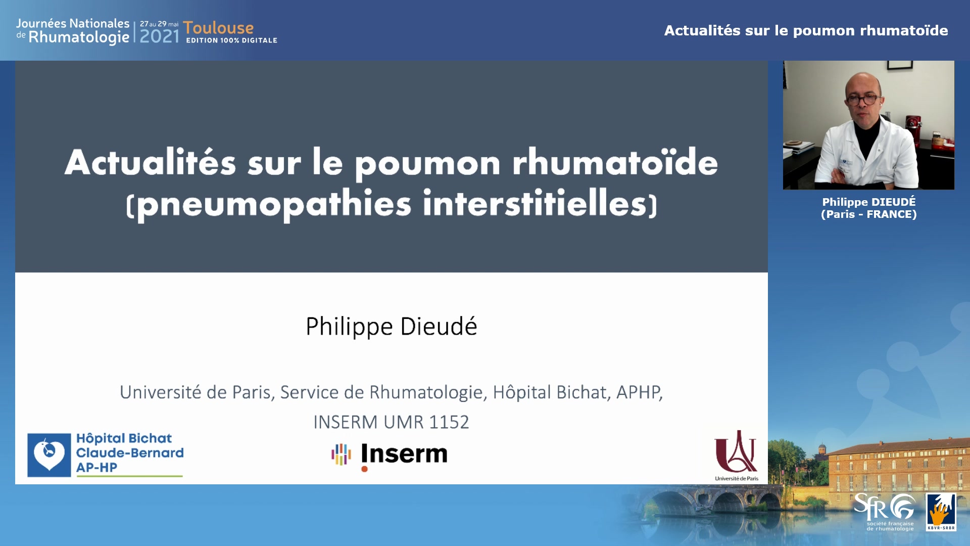 Actualités sur le poumon rhumatoïde